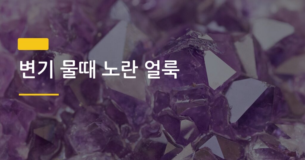 변기 물때 노란 얼룩, 락스 없이 5분 만에 지우는 3가지 방법